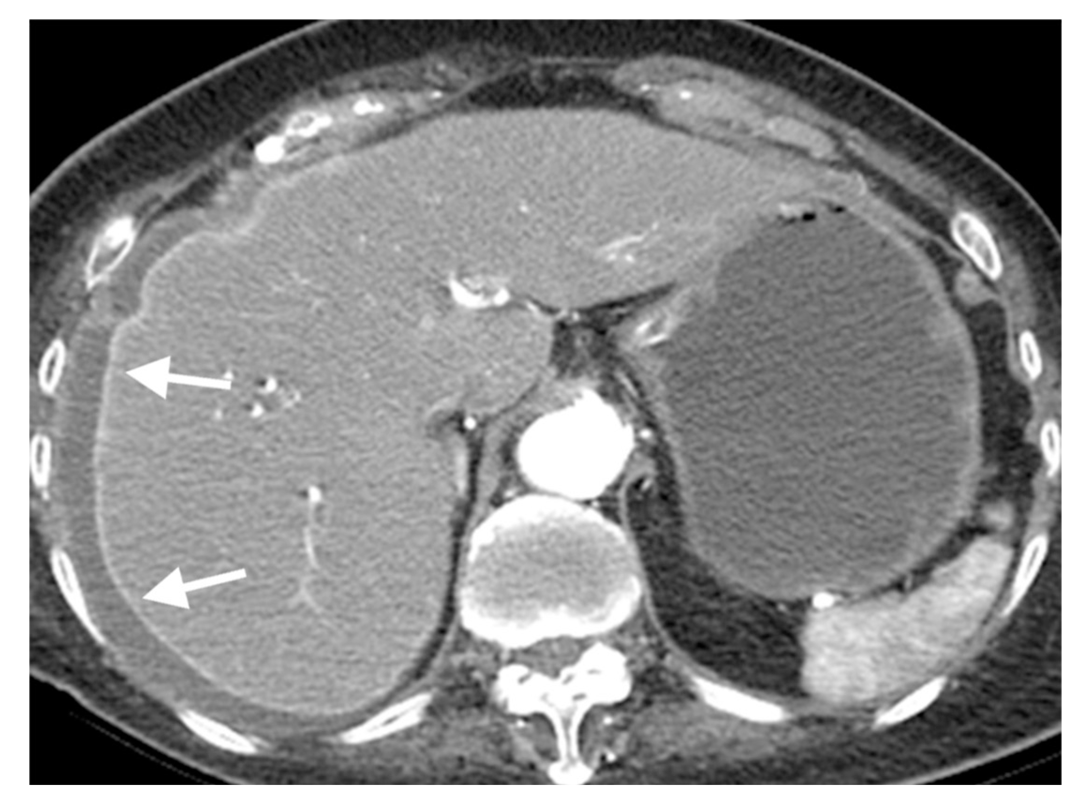 Axial contrast-enhanced computed tomography scan