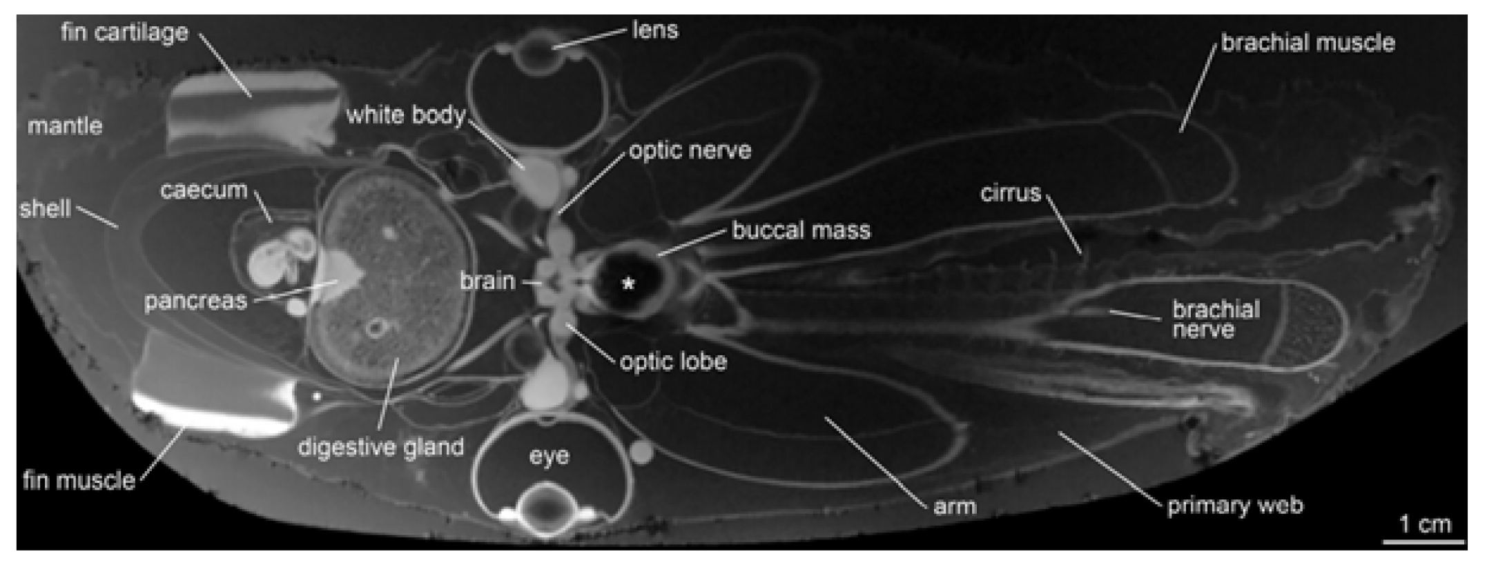 Virtual section of Emperor dumbo octopus through the 3D MRI dataset with anterior facing right. (Credit: Ziegler and Sagorny, BMC Biology, 2021) [2] Figure